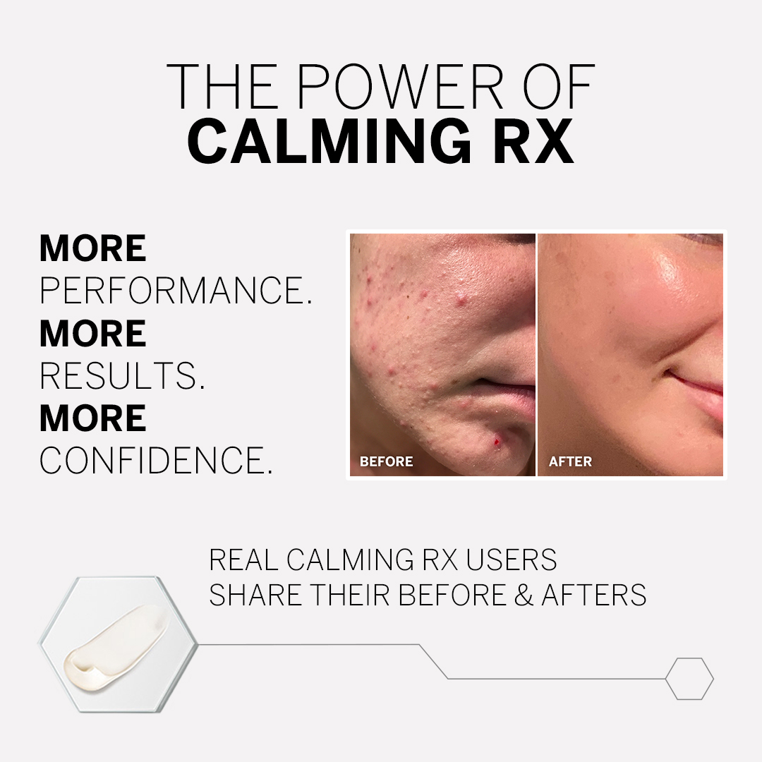 CALMING RX Skincare Before and Afters BABOR Skincare